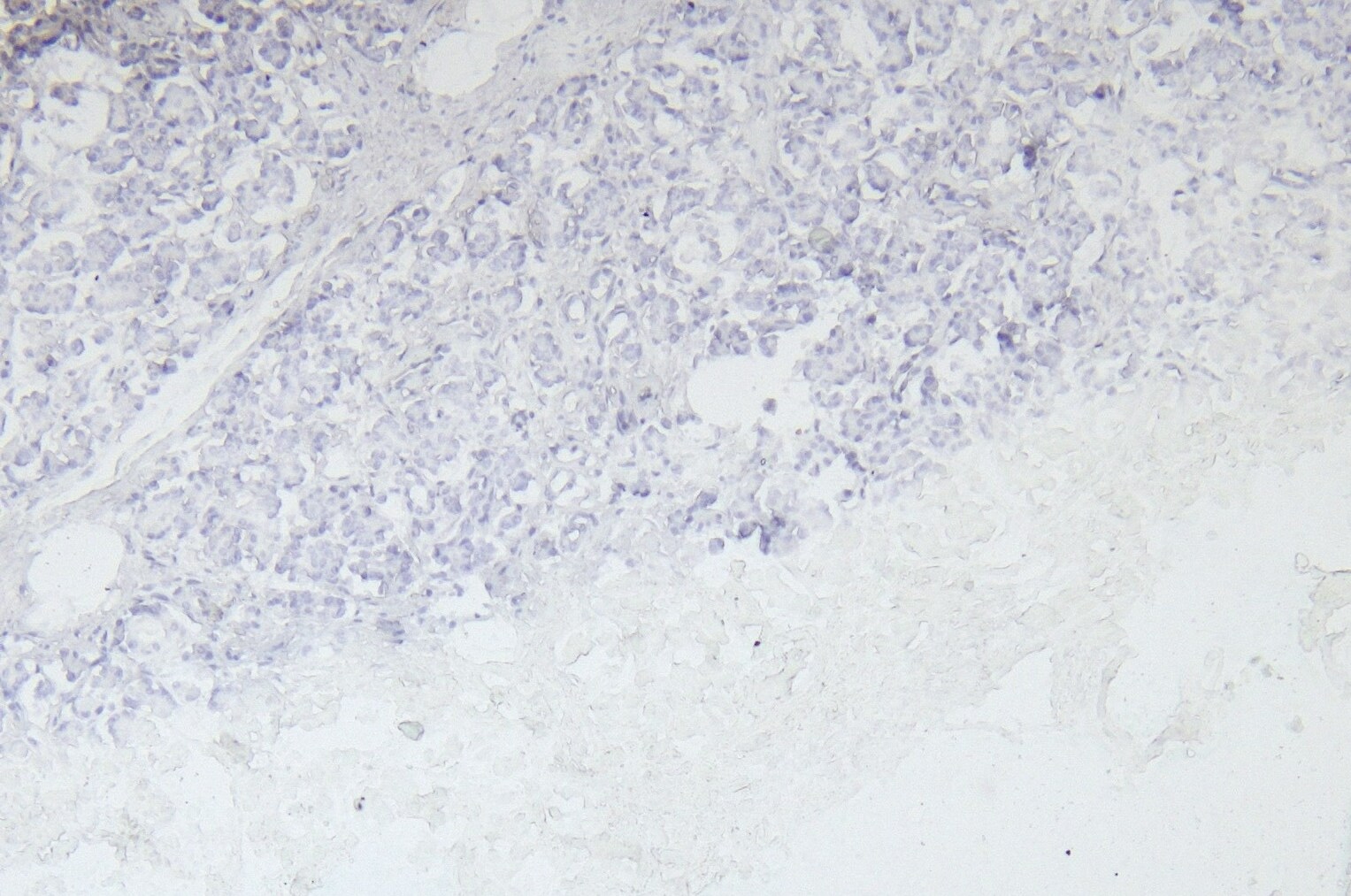 Eps8 Antibody