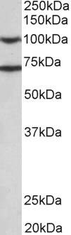 Eps8 Antibody