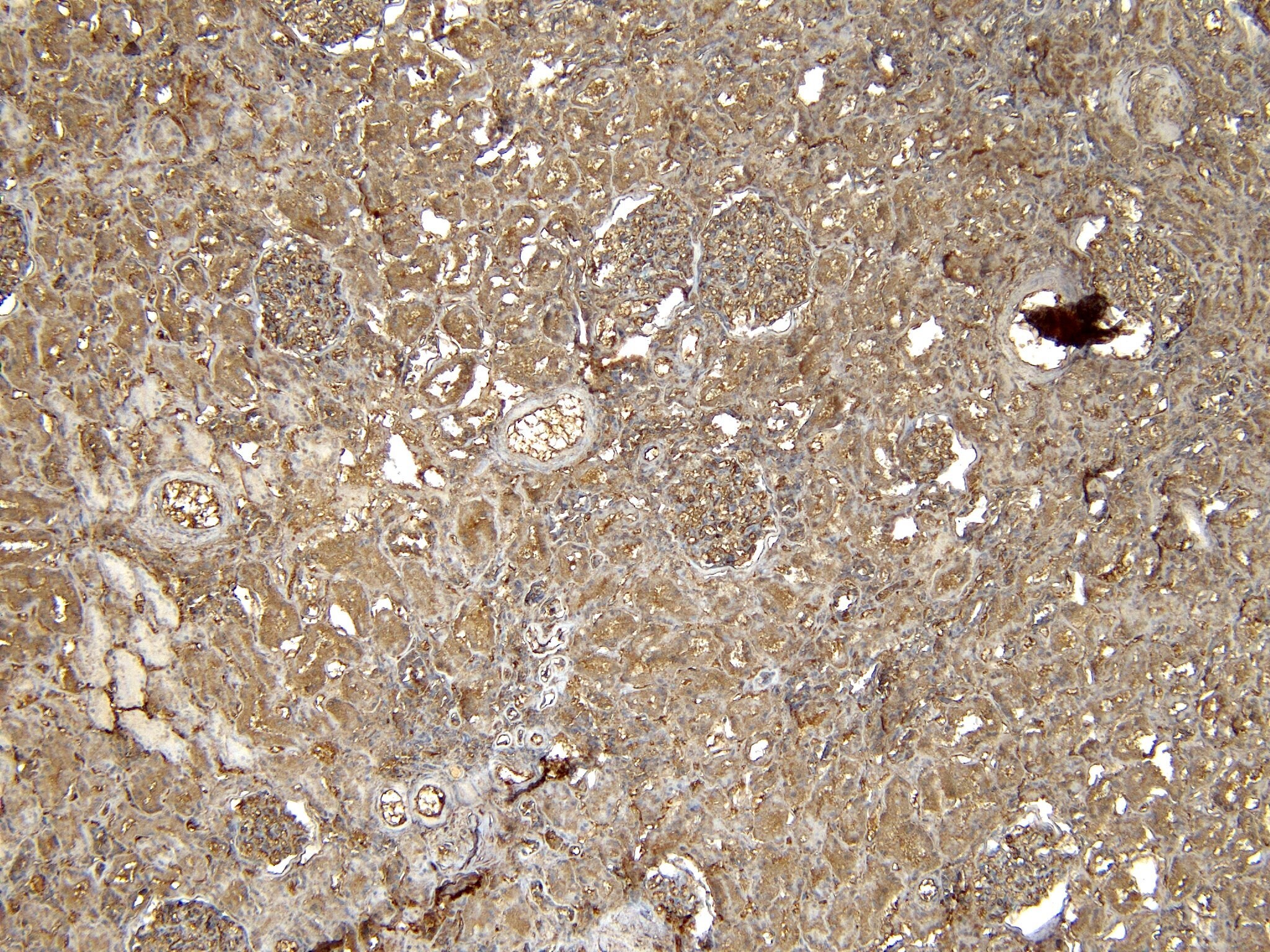 Eps8 Antibody