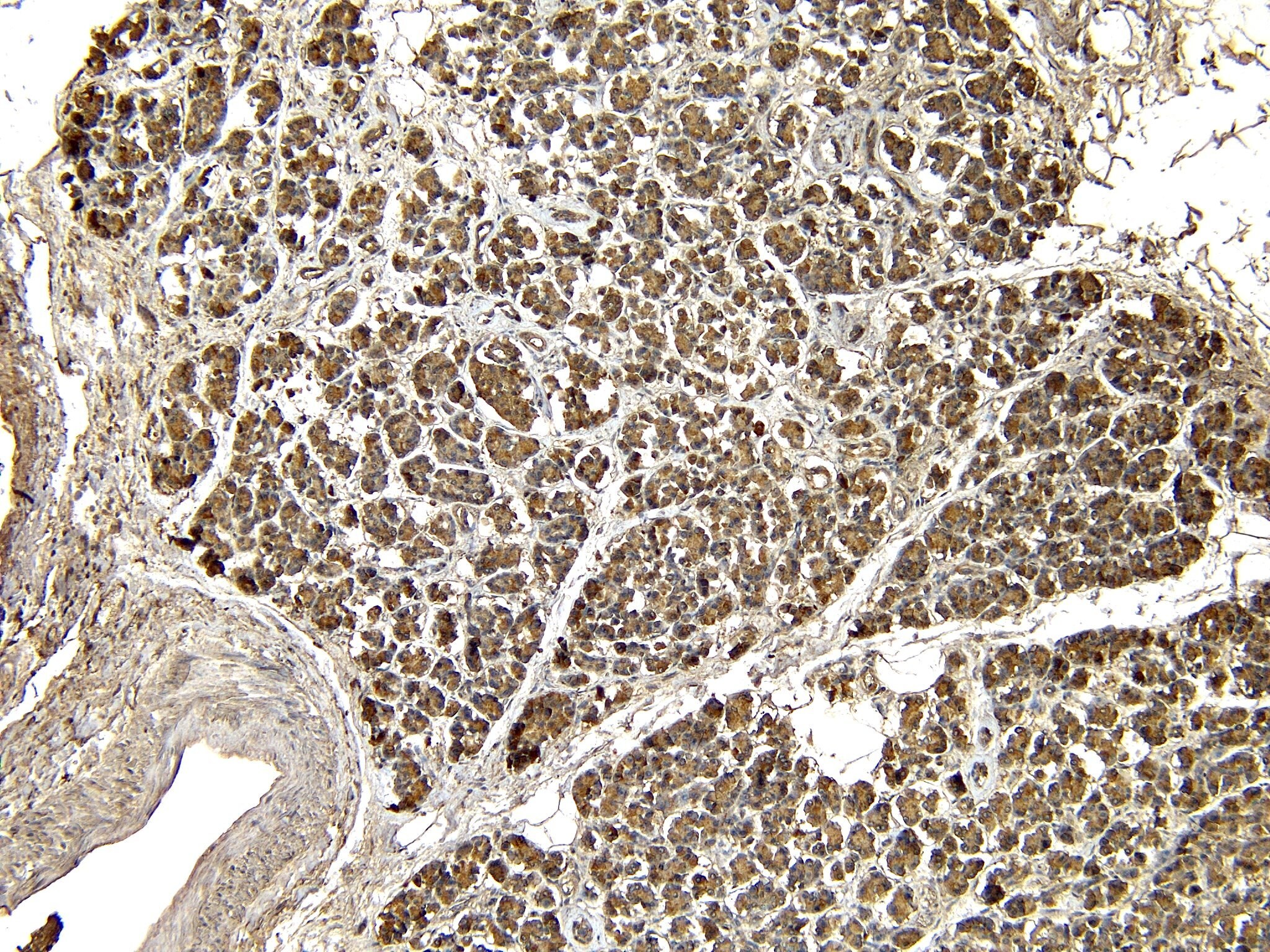 Eps8 Antibody