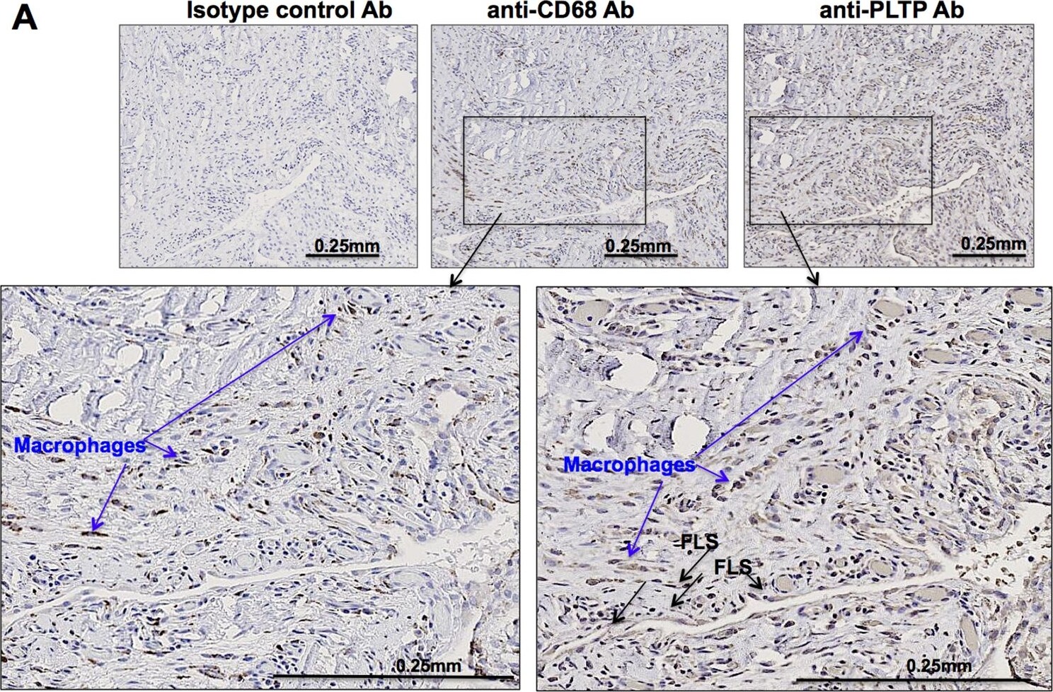 PLTP Antibody