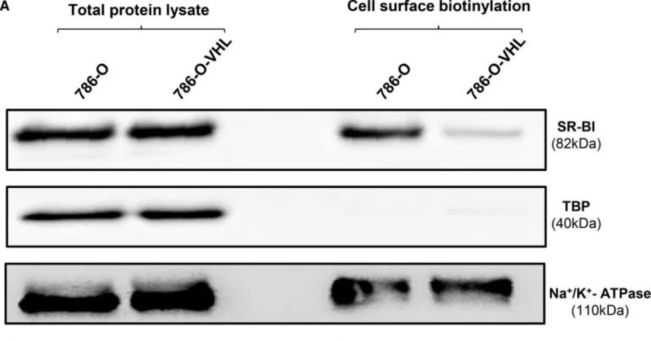 SR-BI Antibody