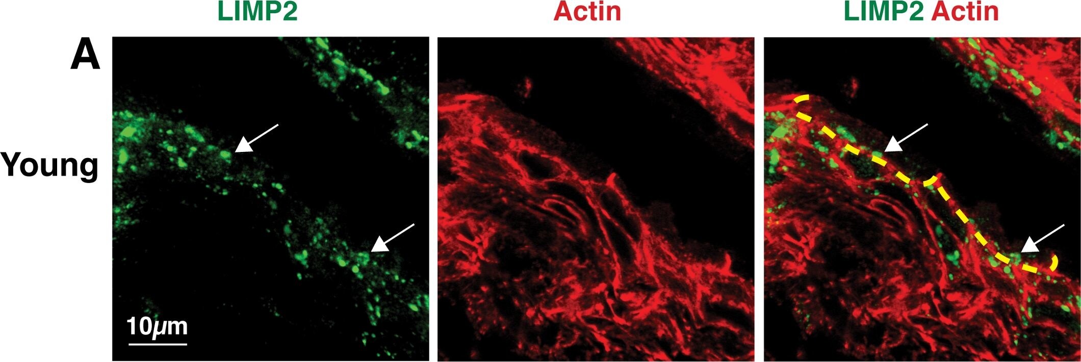 LIMPII/SR-B2 Antibody