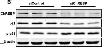 CHREBP Antibody - BSA Free