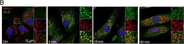 Niemann-Pick C1 Antibody - BSA Free