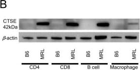 Cathepsin E Antibody