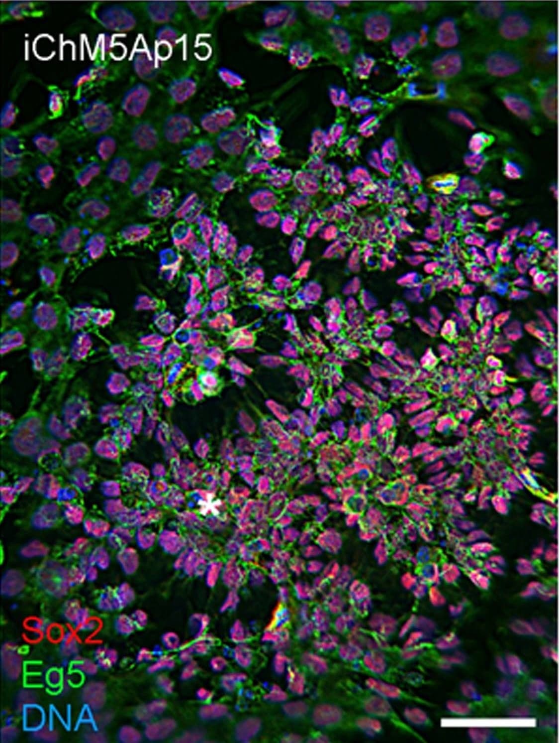 Eg5 Antibody