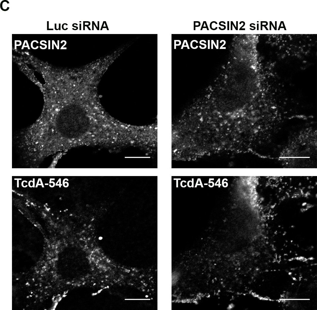 Clostridium Difficile Toxin A Antibody (PCG4.1) - BSA Free