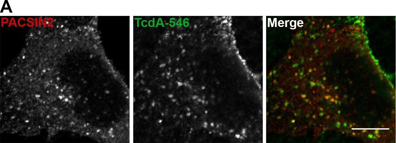 Clostridium Difficile Toxin A Antibody (PCG4.1) - BSA Free