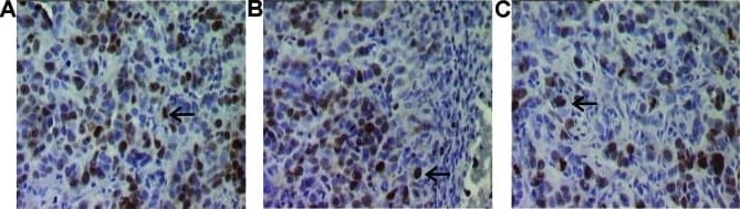 Ki67/MKI67 Antibody (SP6) - Unpurified