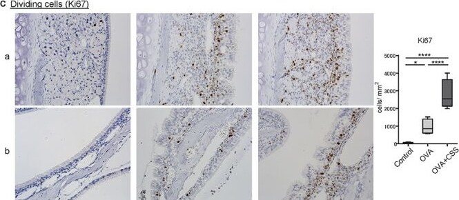 Ki67/MKI67 Antibody (SP6) - Unpurified