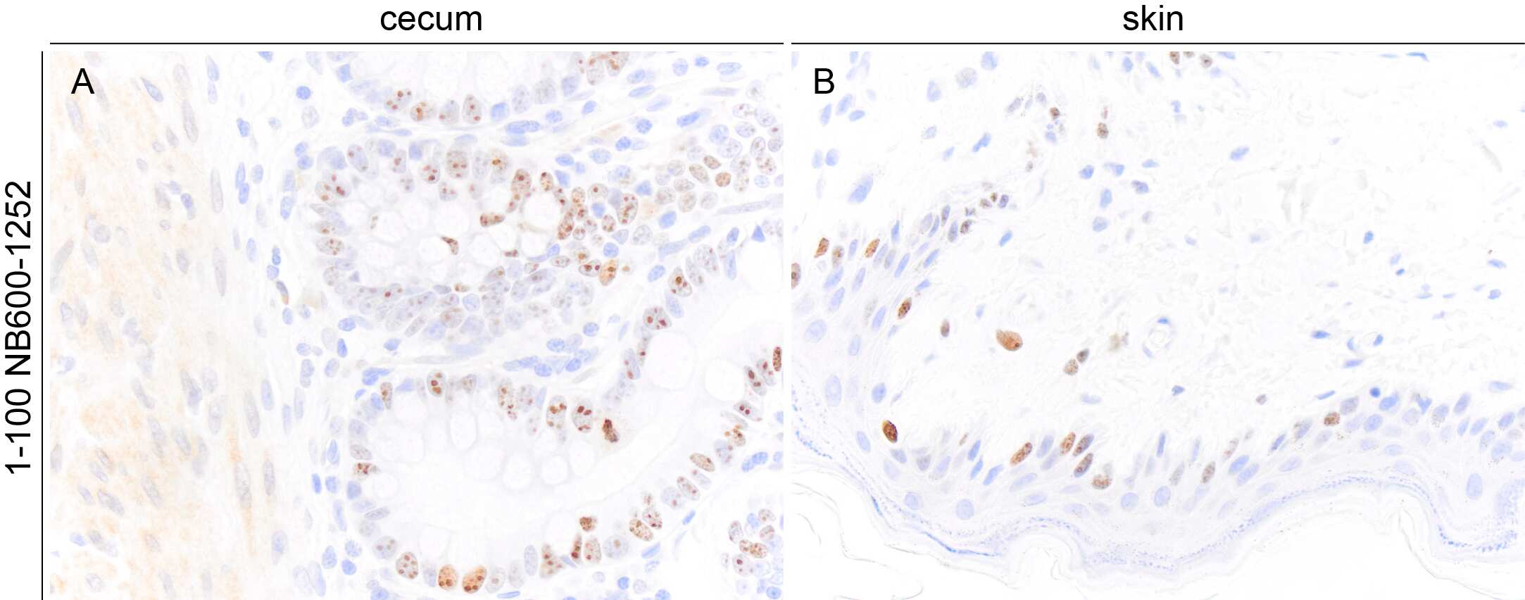Ki67/MKI67 Antibody (SP6) - Unpurified