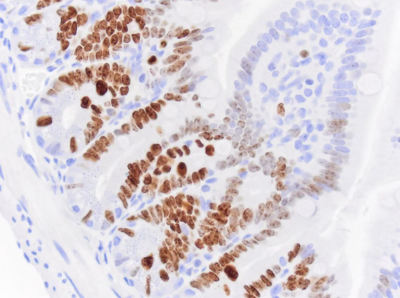 Ki67/MKI67 Antibody (SP6) - Unpurified