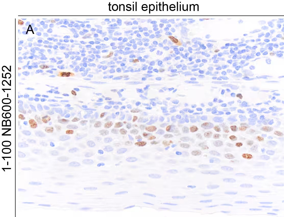 Ki67/MKI67 Antibody (SP6) - Unpurified