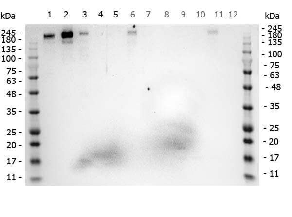 ROBO1 Antibody