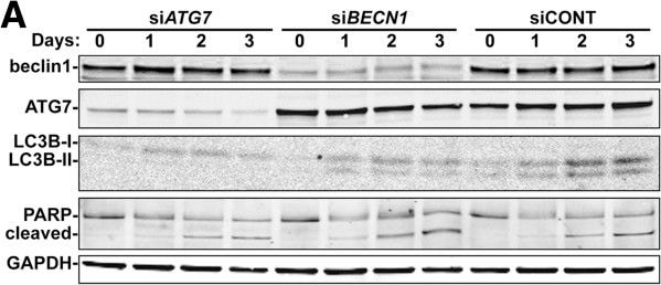 LC3B Antibody - BSA Free