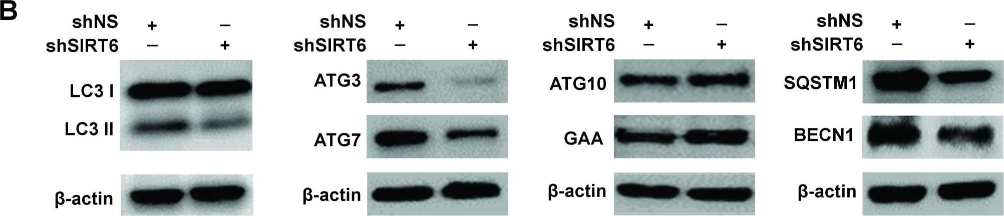 LC3B Antibody - BSA Free