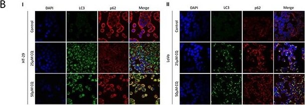 LC3B Antibody - BSA Free