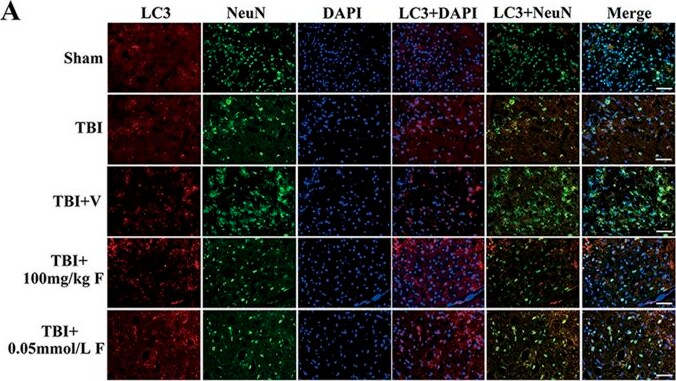 LC3B Antibody - BSA Free