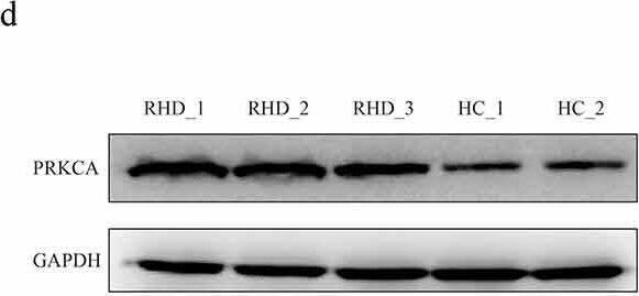 PKC alpha Antibody (MC5) - BSA Free