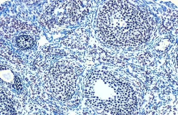 E2F-1 Antibody (18E10)