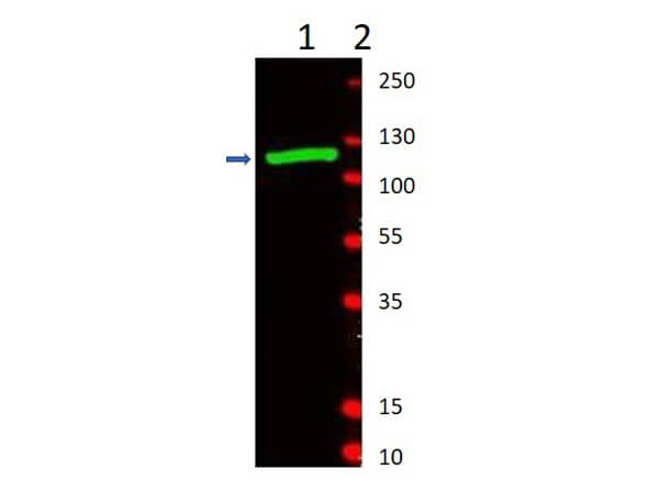 beta Galactosidase Antibody