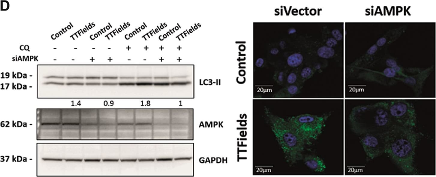 Luciferase Antibody (Luci 21 1-107) - BSA Free