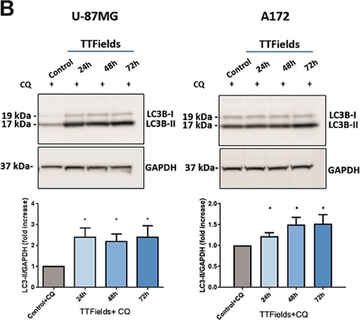 Luciferase Antibody (Luci 21 1-107) - BSA Free