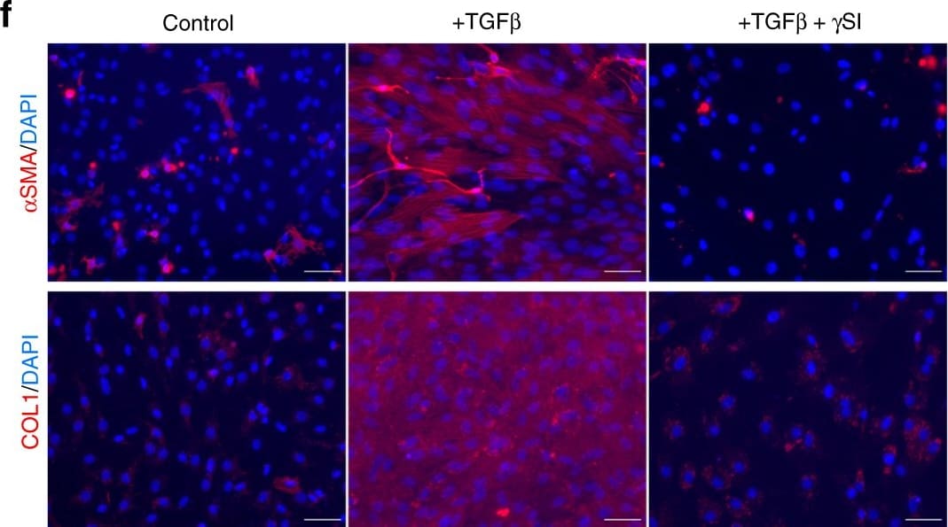 Collagen I Antibody