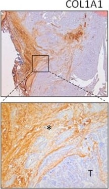 Collagen I Antibody
