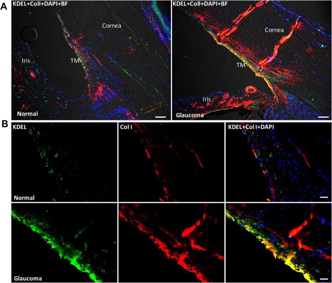 Collagen I Antibody