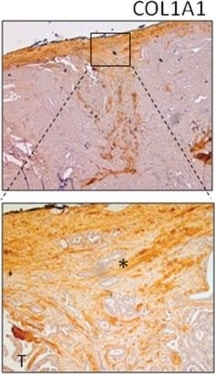 Collagen I Antibody