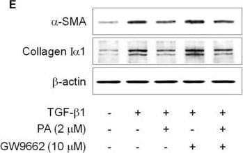 Collagen I Antibody