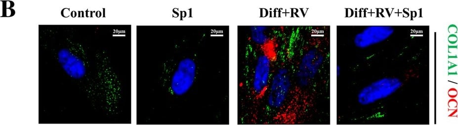Collagen I Antibody
