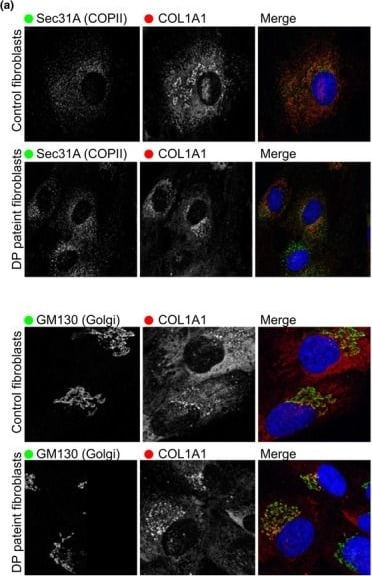 Collagen I Antibody