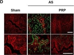 Collagen I Antibody