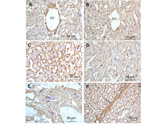 Staining of Collagen I in Paraffin Embedded Liver Tissue