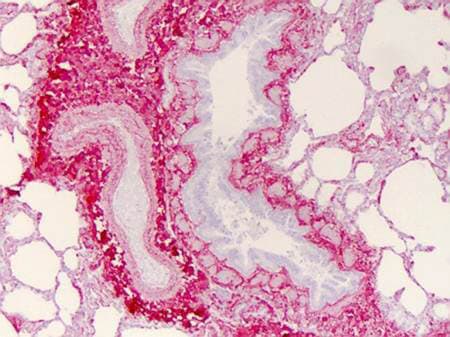 Staining of Collagen I in Paraffin Embedded Human Lung Tissue