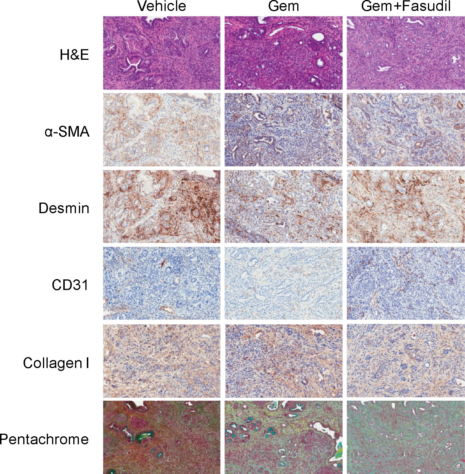 Collagen I Antibody