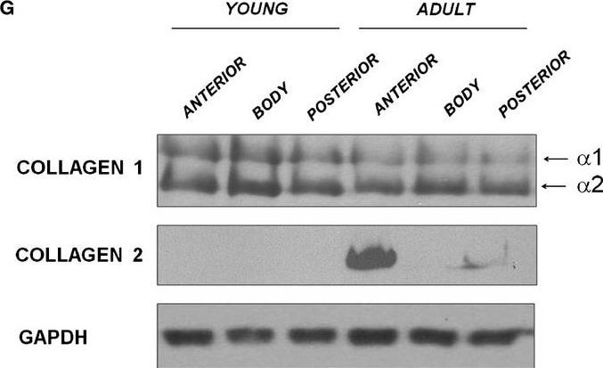 Collagen I Antibody