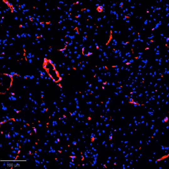 Collagen I Antibody [Janelia Fluor® 549]