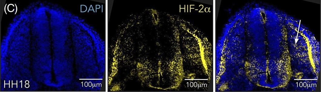 HIF-2 alpha/EPAS1 Antibody (ep190b)