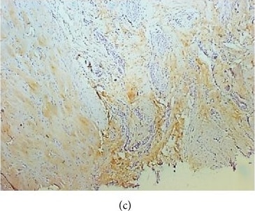 Collagen I alpha 1 Antibody (COL-1)