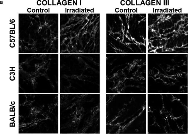 Collagen I alpha 1 Antibody (COL-1)
