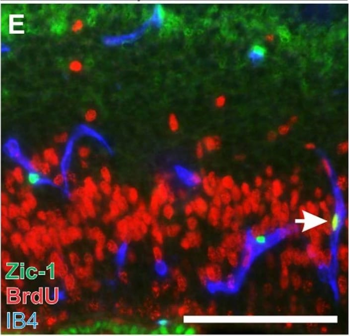 ZIC1 Antibody - BSA Free