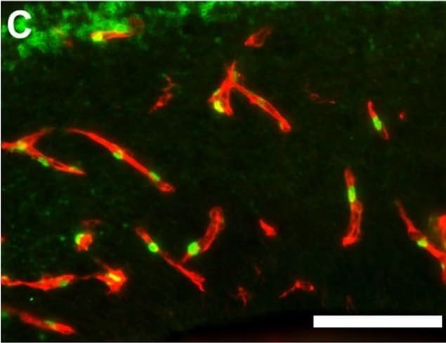 ZIC1 Antibody - BSA Free