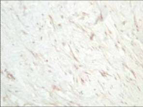 sFRP-1 Antibody