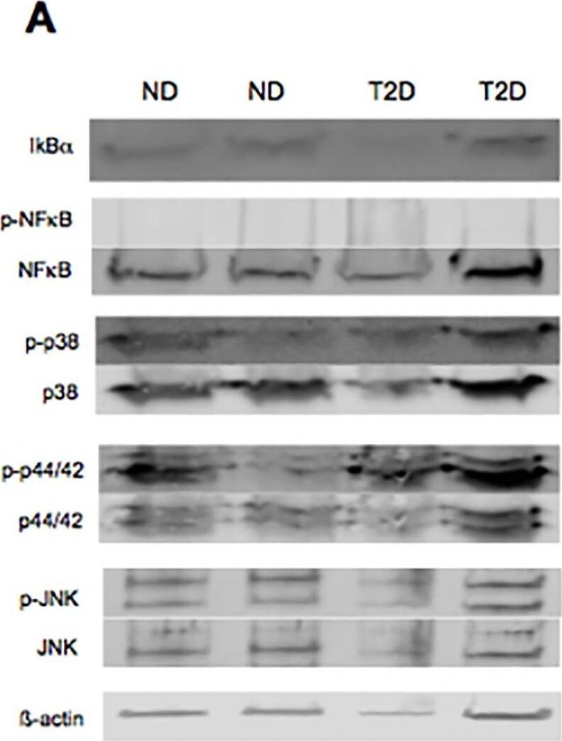 beta-Actin Antibody