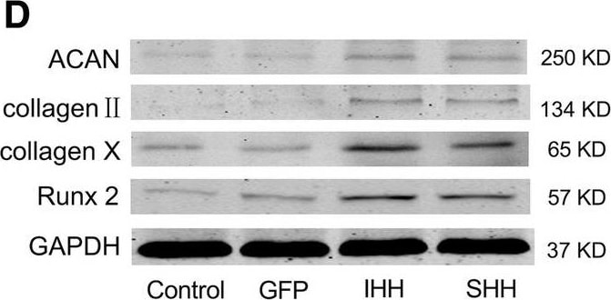 Aggrecan Antibody (BC-3) - BSA Free