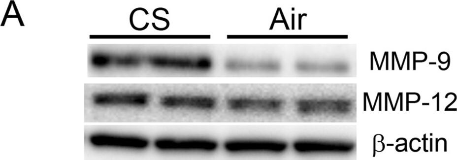 beta-Actin Antibody
